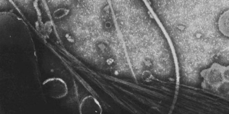 O caso foi registrado em Salvador, na Bahia - Reprodução