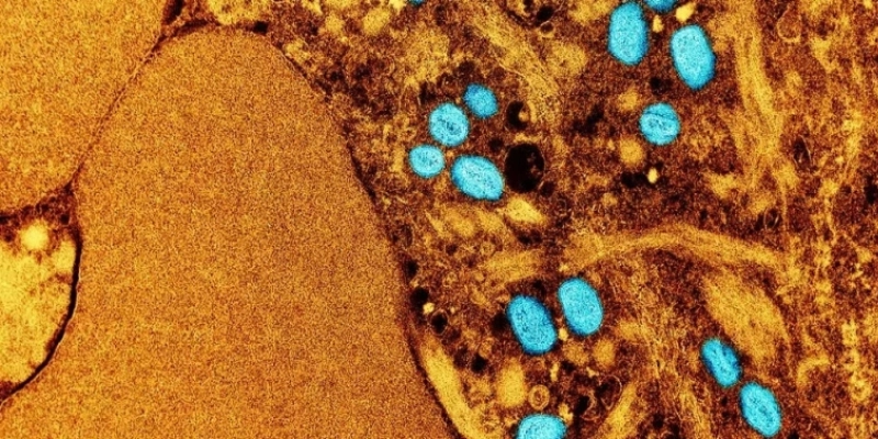 Partículas do vírus da mpox vistas em microscópio eletrônico - Reprodução/NIAD