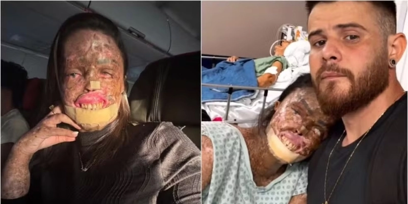 Influencer cearense com doença rara morre após duas semanas de internação - Reprodução