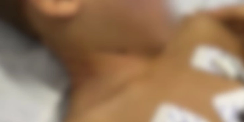 Após agressão cometida pela tia, a criança recebeu atendimento emergencial e permanece sob observação médica - Divulgação/Polícia Civil