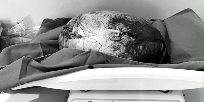 Cirurgia de urgência foi realizada no Hospital Regional de Guarabira (HRG) - Divulgação/Secom-PB