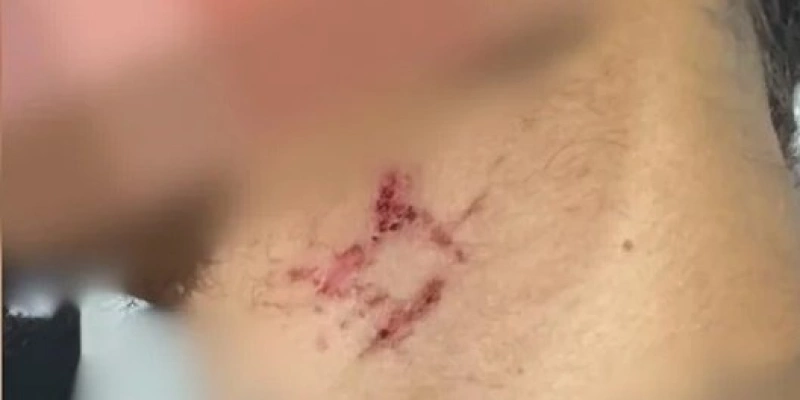  - Divulgação / PCGO